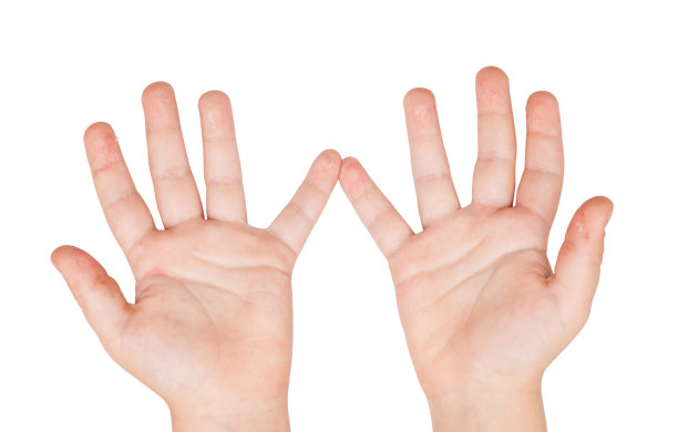 那孩子得了猩红热。皮肤去角质的第一阶段图片下载