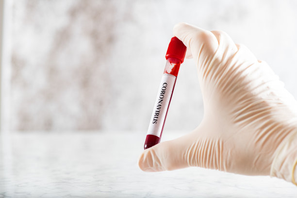 冠状病毒血液样本素材图片
