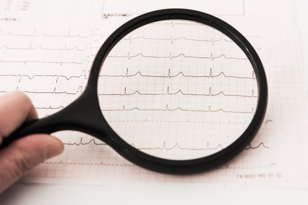 用放大镜仔细观察心电图的真实照片图片下载
