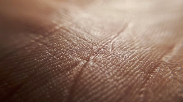 皮肤病的概念。人类手部的宏观皮肤。医学和皮肤科的概念。人类皮肤背景的细节图片下载