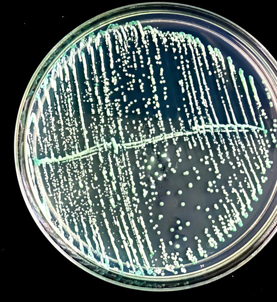 铬琼脂上生长的白色念珠菌图片下载