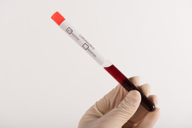 戴手套的手拿着装有新型冠状病毒血液的试管插画图片下载