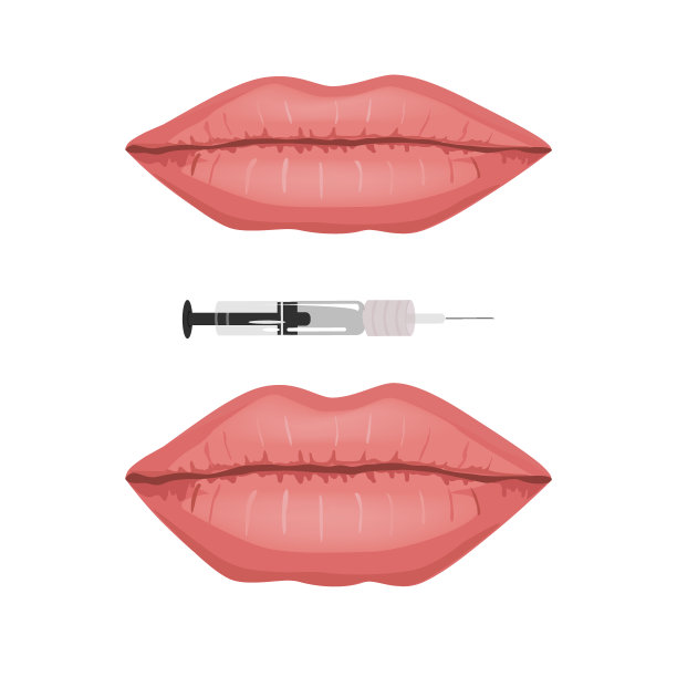 女性嘴唇前后填充注射，矢量信息插图。美丽和性感完美的嘴唇孤立在白色的背景图片下载