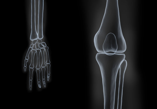 手和膝盖的x光片图片下载