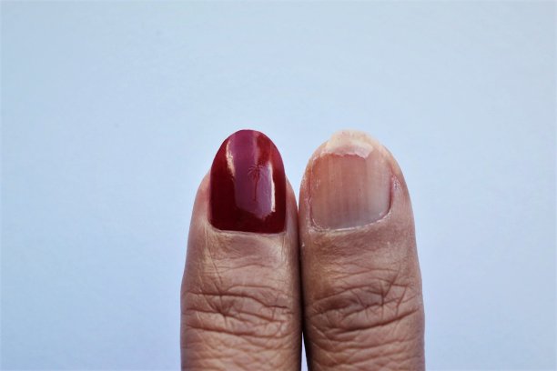 女性的不同拇指图片下载