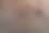 鳞状细胞癌和Mohs手术图片下载