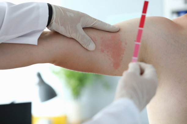 戴防护手套的医生图片下载