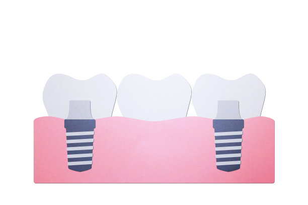 植牙，植牙过程及更换牙根图片下载