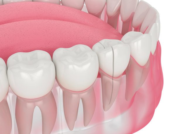颚与裂齿的3d渲染图片下载