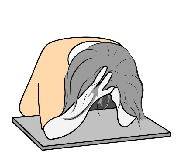 这个女孩有抑郁症。找不到出路。坏心情。矢量插图。图片下载