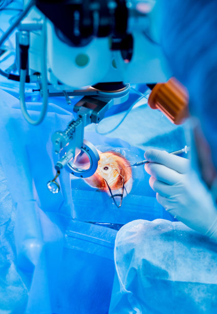 眼科手术：白内障手术图片下载