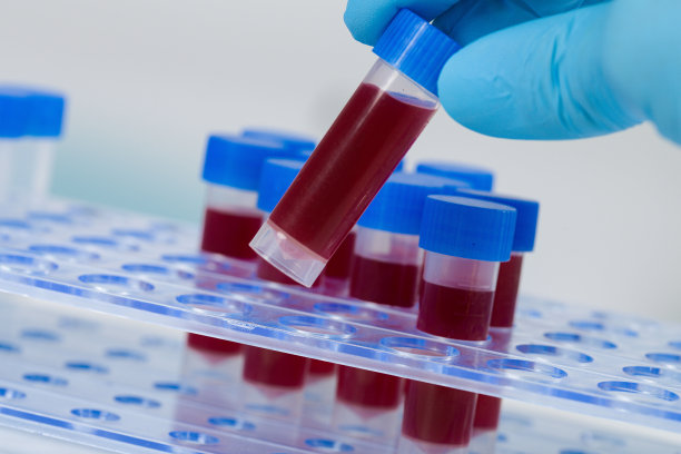 戴医用手套的手从架子取出血液样本图片下载