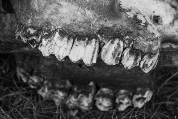 后牙齿图片下载