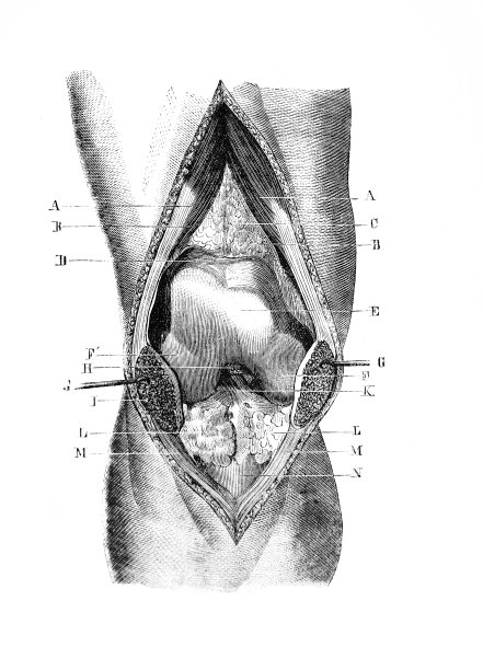 旧书《外科解剖学》中的膝盖部位，作者B. Anger, 1869年，巴黎图片下载