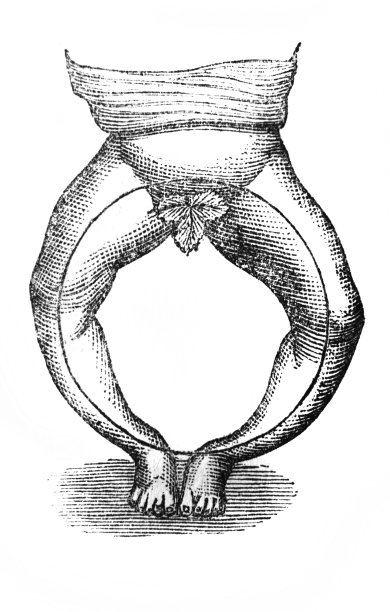 a . Tauber, 1889年，圣彼得堡的旧书《外科学校》中描述了儿童腿部的弯曲图片下载