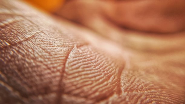 皮肤疾病概念。人手皮肤宏观图。医学与皮肤病学概念。人类皮肤背景细节图片下载