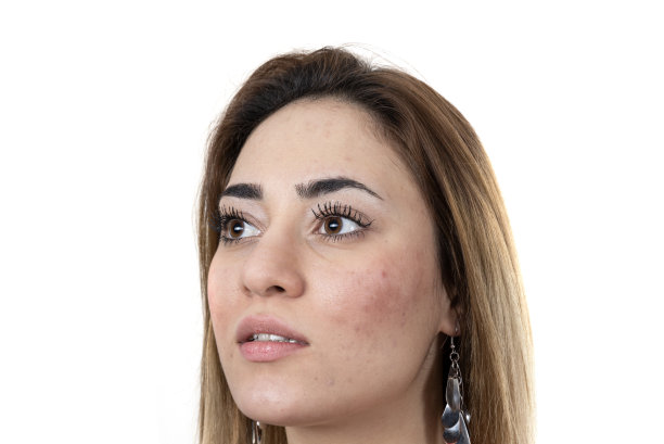 未经过滤的年轻女性皮肤。没有过滤。图片下载