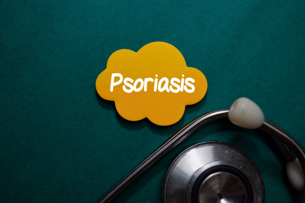 牛皮癣写在便利贴上隔离在办公桌上。医疗保健或医疗概念图片下载