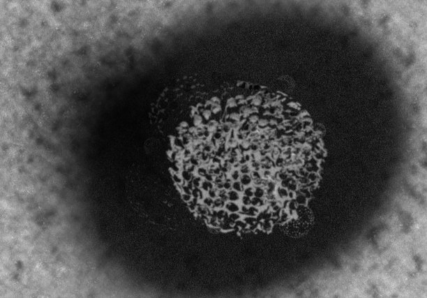 病毒的图片图片下载