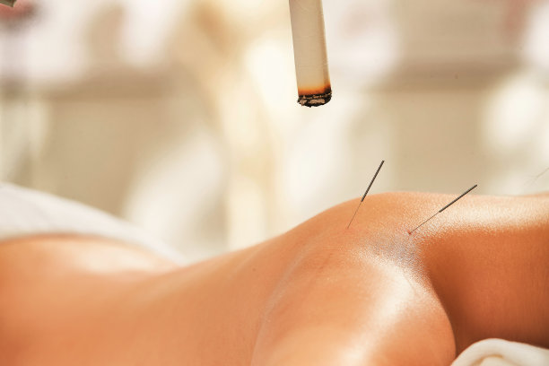 中医艾灸与针灸图片下载