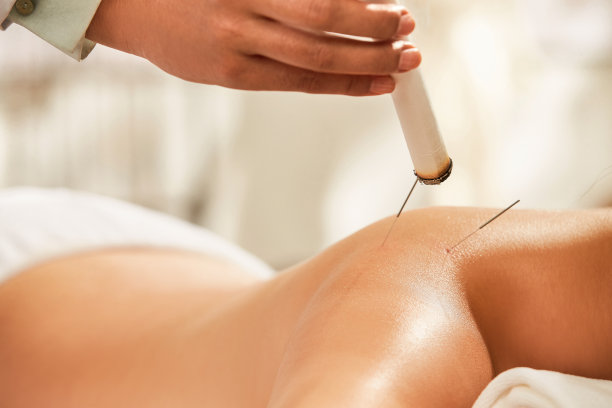 中医艾灸与针灸图片下载