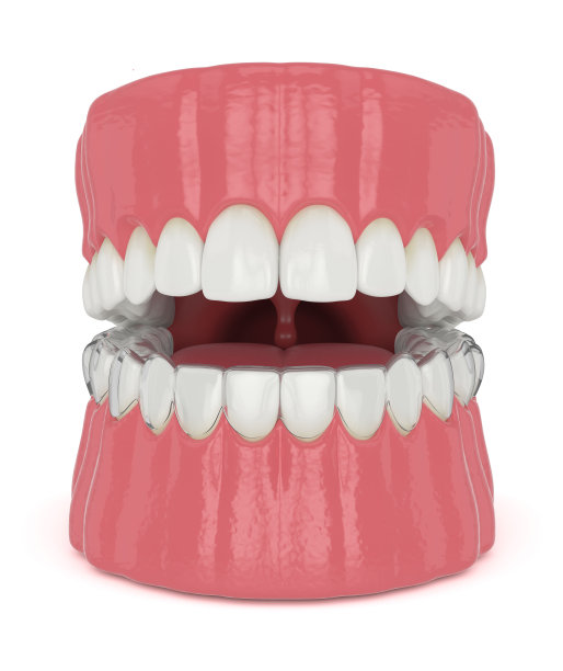3d渲染颌骨与不可逆对齐可拆卸保持器图片下载