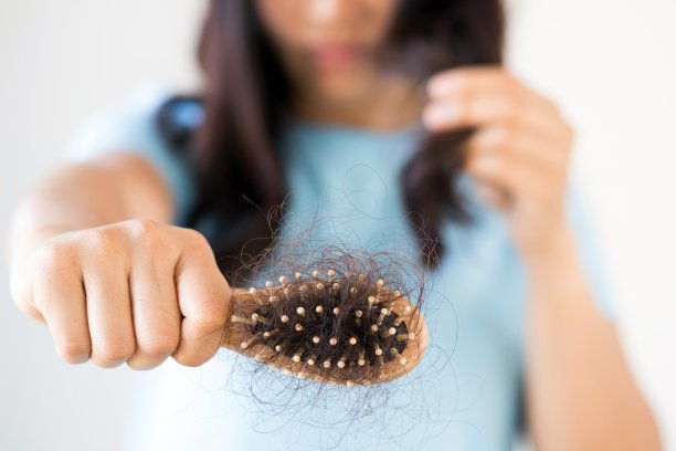 女性的脱发是由压力和对洗发水过敏引起的。图片下载