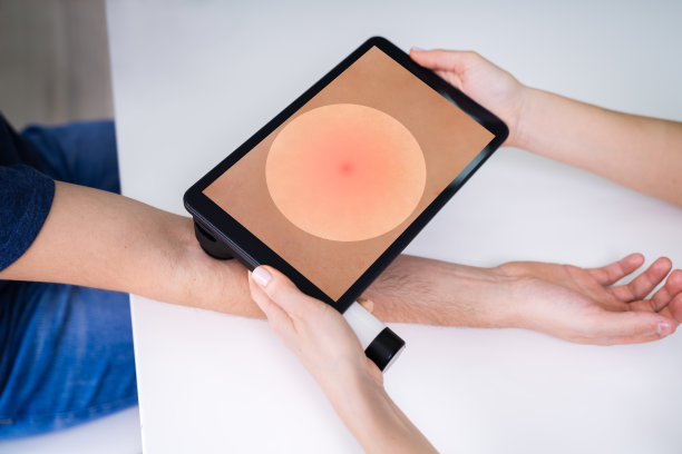 医生检查色素沉淀皮肤图片下载