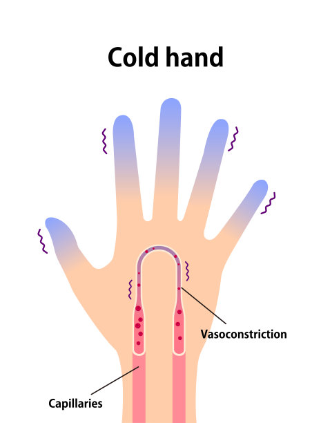 手冷血循环图(对寒冷敏感，指尖冷)图片下载