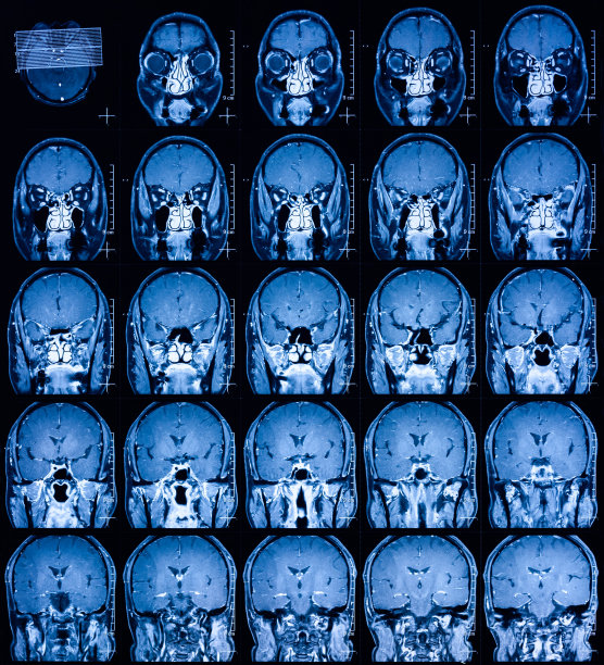 MRI扫描人类头部断层扫描后视图图片下载