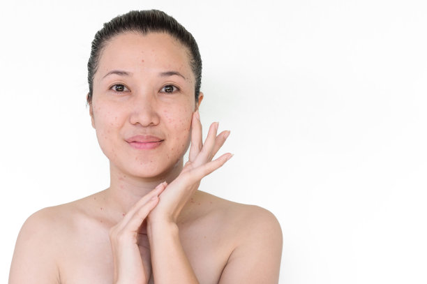 激光治疗图片下载