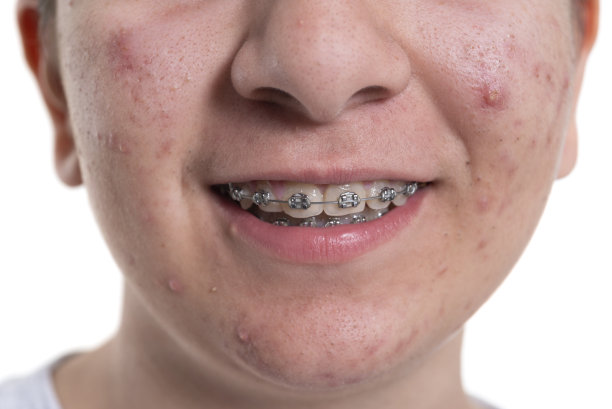 少女的烦恼图片下载