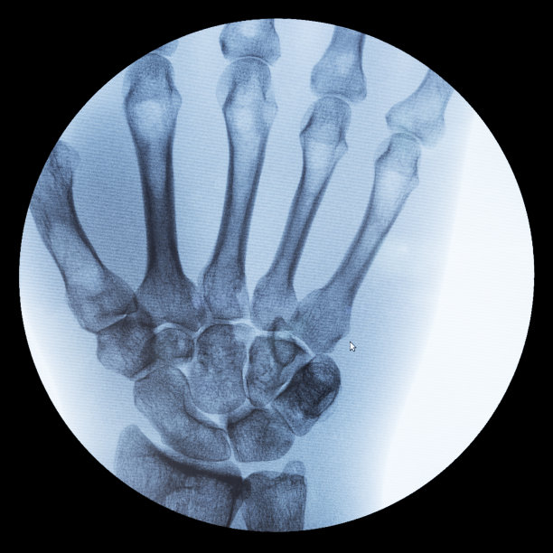 人手X光片图片下载