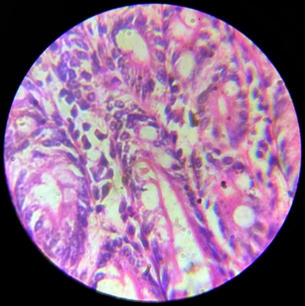 显微镜下的人体肠道活检图片下载