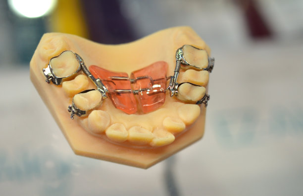 正畸牙模型义齿教育模型。图片下载