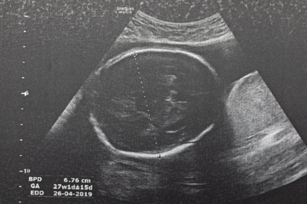 孕妇胎儿超声检查，医生通过超声读取孕妇检测结果。图片下载