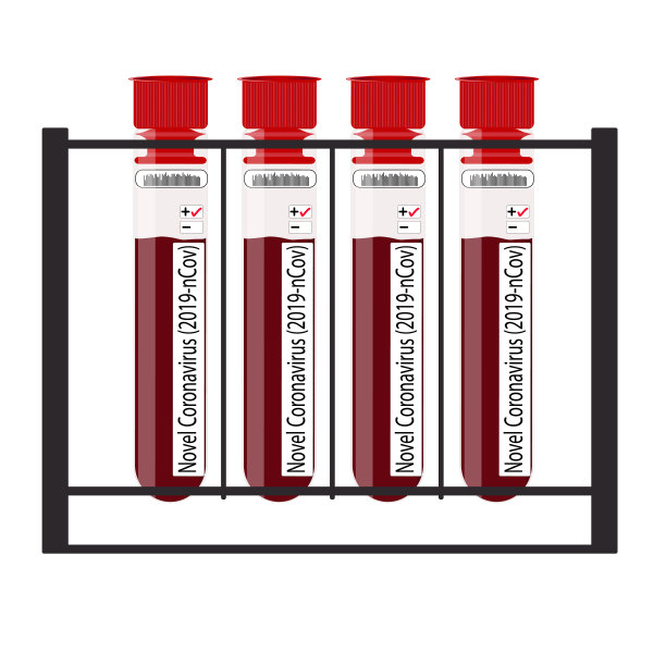 微生物血液样本，许多其他试管检查分析医院结果显示新型冠状病毒(2019-nCoV)载体插图阳性图片下载