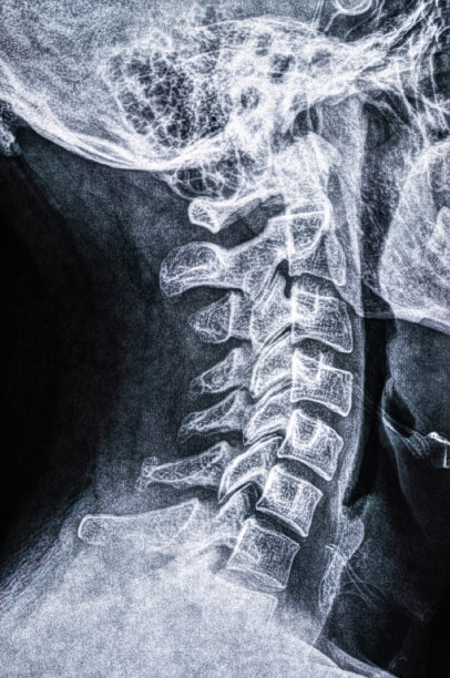 人体颈部x光扫描图片下载