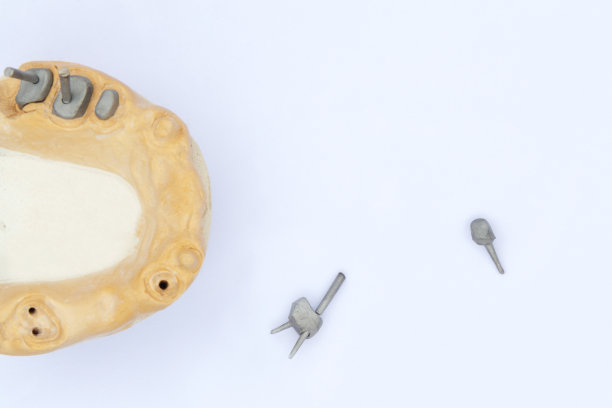 牙科针，柱和铸柱。左边是上颌的石膏模型。牙根修复术的概念。整形牙科图片下载