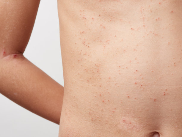 孩子皮肤上的伤口图片下载