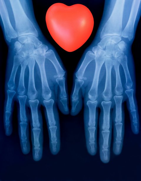 人类双手骨骼和红色心脏标志的X光片图片下载
