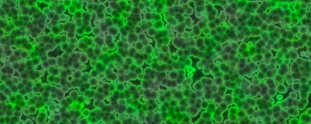 冠状病毒新型冠状病毒肺炎3 d渲染背景。图片下载