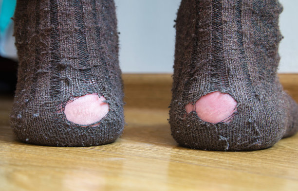 脚上的失业者穿着破袜子，脚跟上有大洞，贫穷和经济危机的概念抽象形象，失业。没钱买新衣服。图片下载