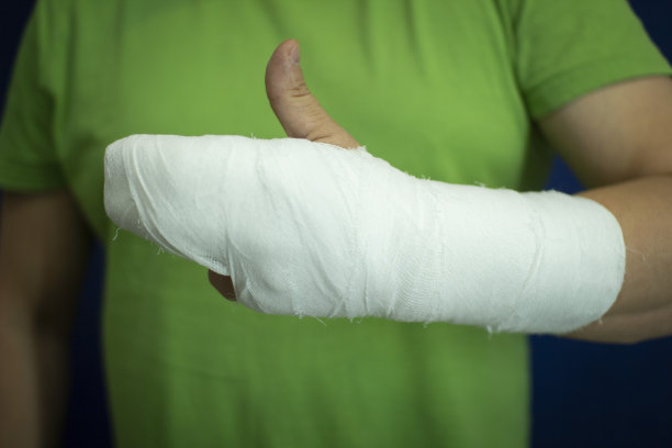 一个手臂上打着石膏的人。男人的手在手术后的绷带。图片下载