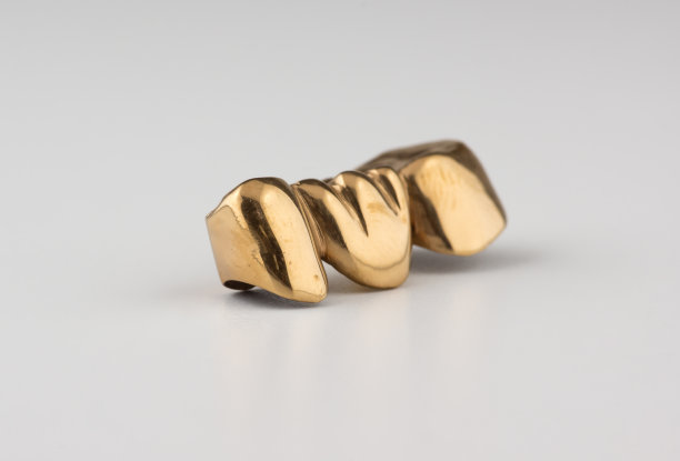 镶金假牙冠图片下载