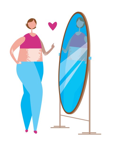 女孩与白癜风和镜子孤立在一个白色的背景设计，平面矢量股票插图与女性作为一个概念的皮肤皮肤病图片下载