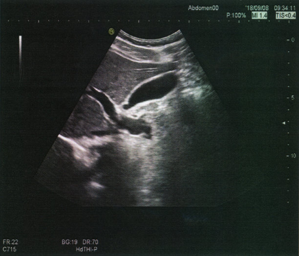 腹部超声医学检查图像图片下载