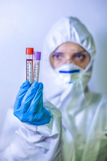 持有COVID-19阳性血管的医生图片下载