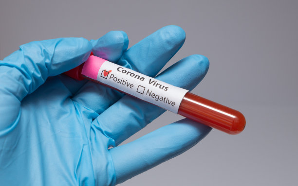 冠状病毒血液检测阳性。医学研究，带血的试管，手拿医用乳胶手套。冠状病毒爆发和流感。2019 - ncov covid-19,非典。高质量的照片。图片下载