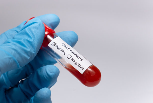 冠状病毒血液检测阳性。医学研究，带血的试管，手拿医用乳胶手套。冠状病毒爆发和流感。2019 - ncov covid-19,非典。高质量的照片。图片下载